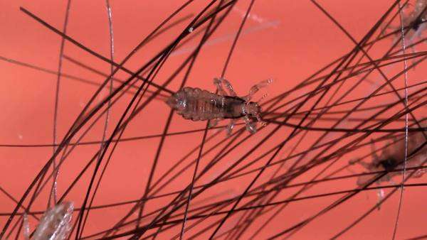 Head Lice Pediculus Humanus Capitis About 3 Mm In Length