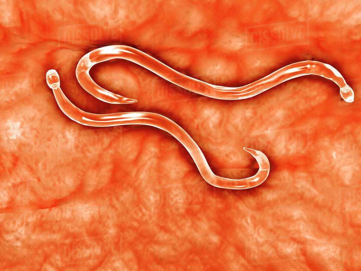 Microscopic view of hookworm. Stock Photo Dissolve