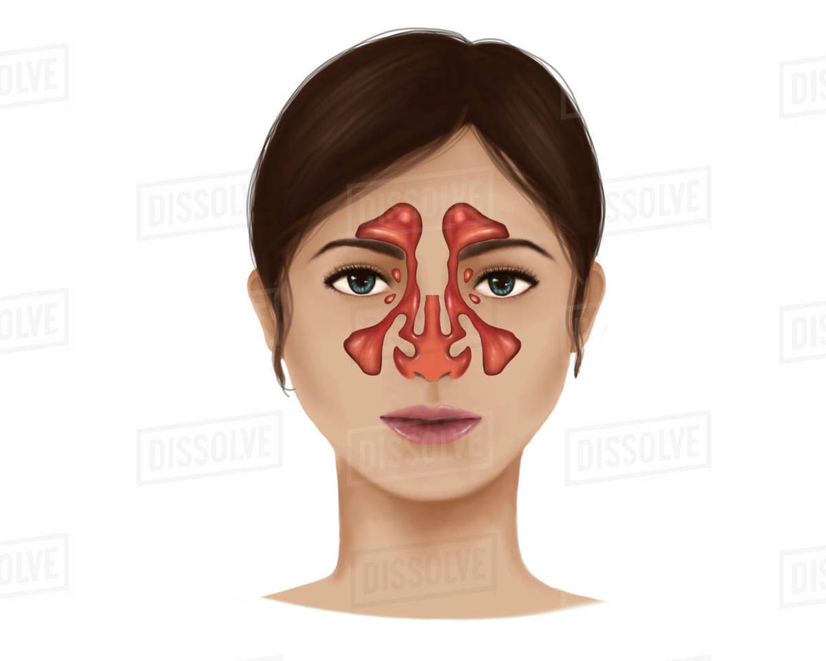 Anatomy of nasal sinuses. - Royalty-free Stock Photo | Dissolve