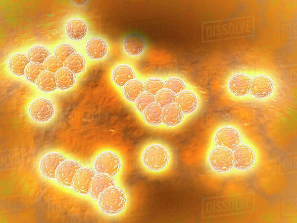 Microscopic view of Methicillin-resistant Staphylococcus aureus (MRSA ...