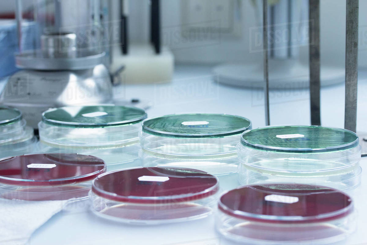 Bacteria growing in petri dishes in lab Stock Photo Dissolve