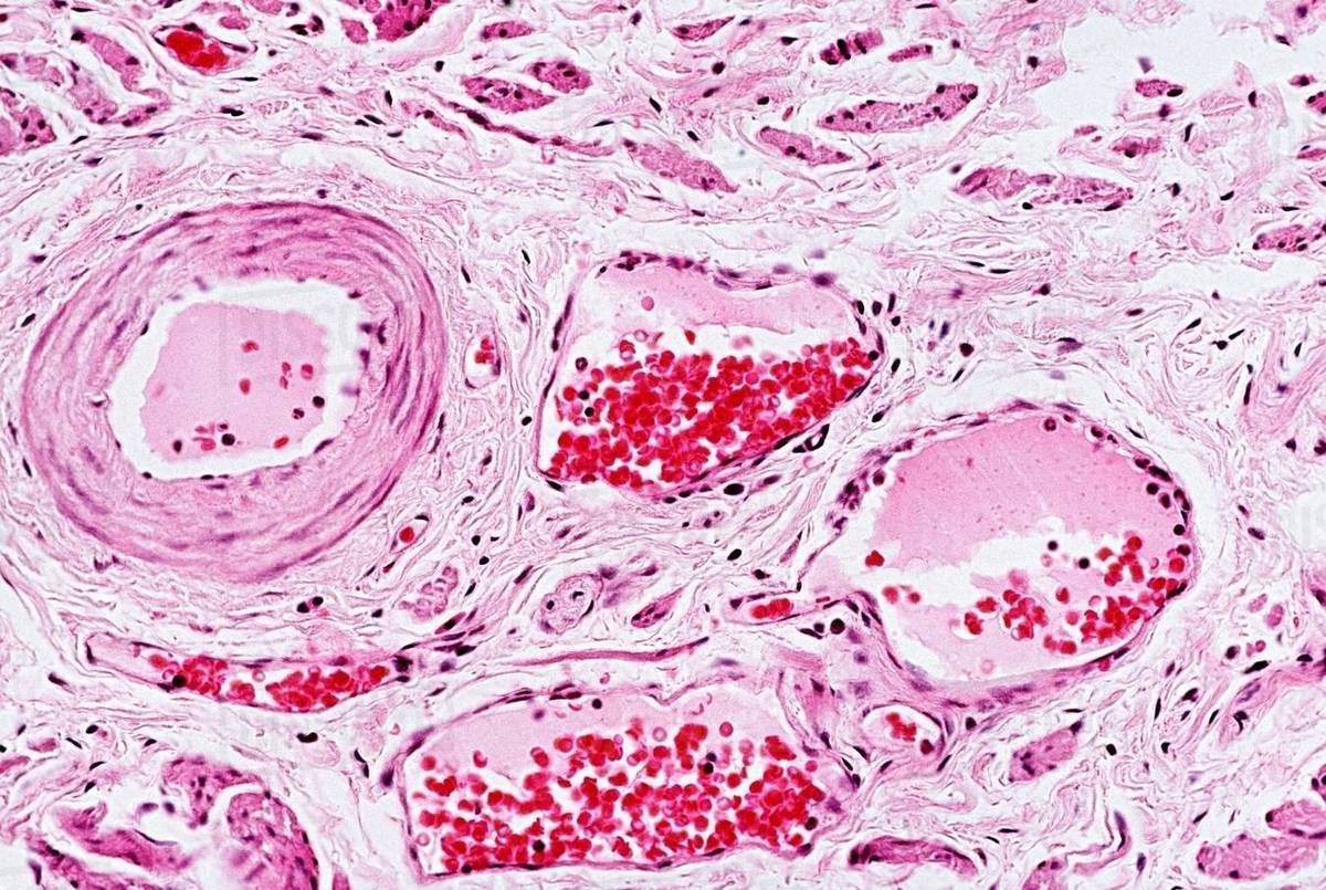 Blood vessels Stock Photo Dissolve