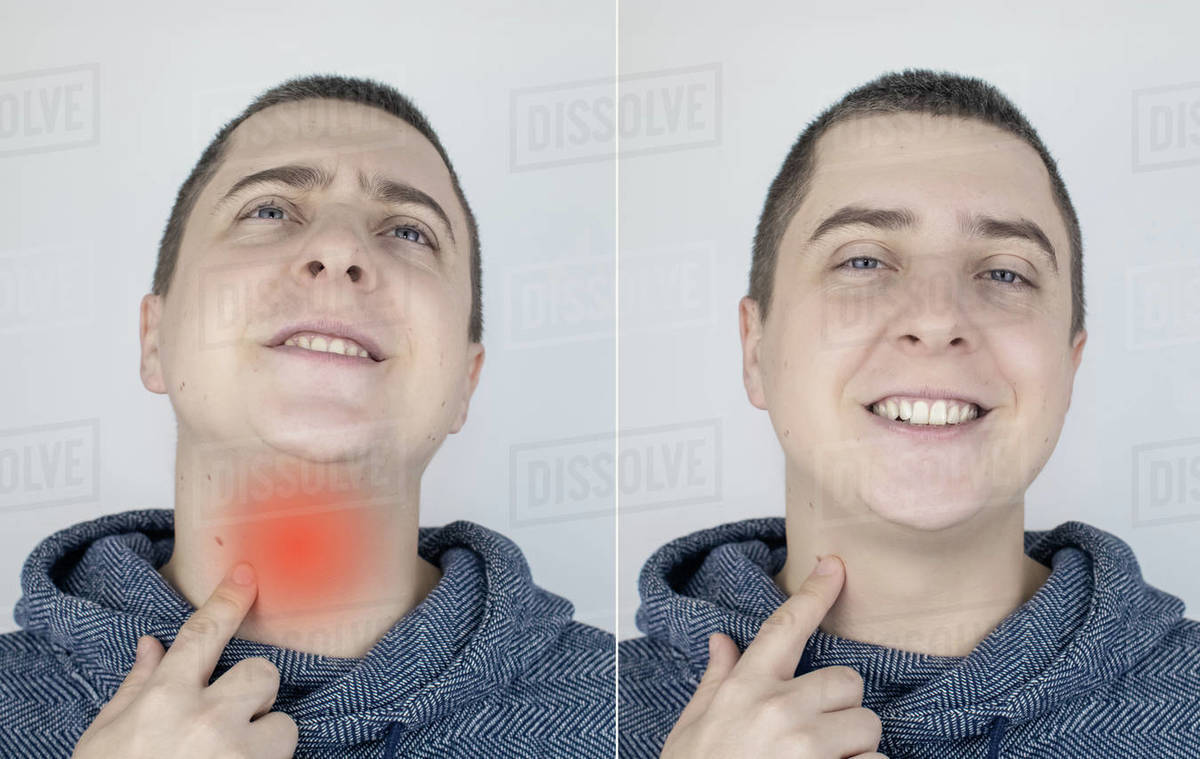Before and after. On the left, the man indicates a sore throat, and on