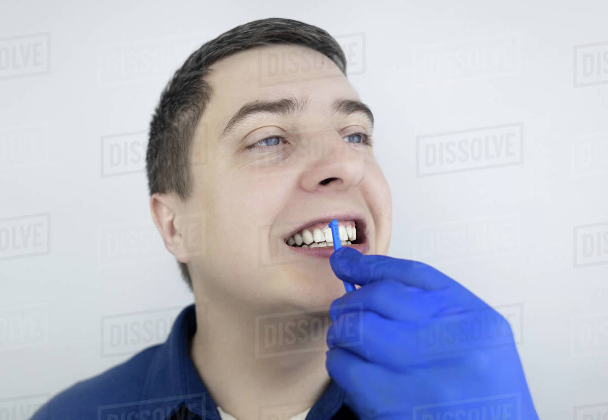 Interdental brush. A man shows a brush for cleaning the interdental