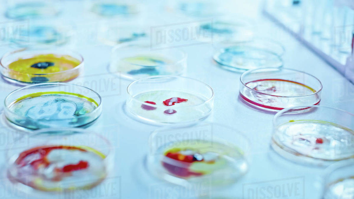 Microbiology Laboratory Petri Dishes with Various Bacteria Samples
