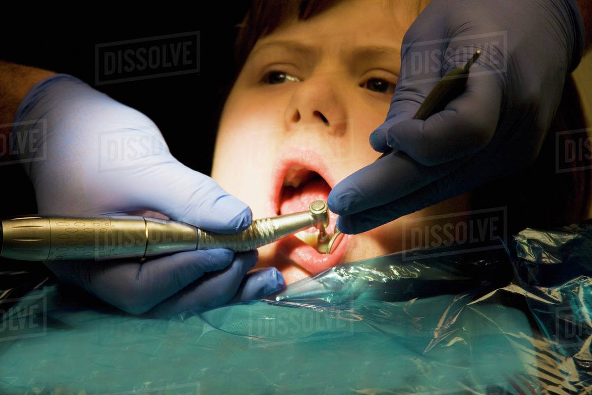 A girl undergoing treatment at the dentist's office;Whitley bay tyne