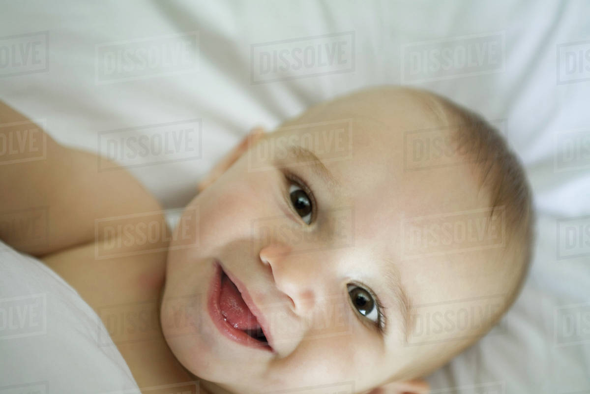 head and shoulders in baby eye